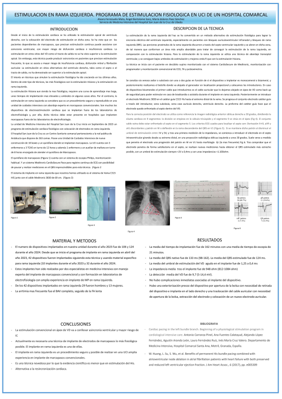 P.M.28. Estimulación en Rama Izquierda. Programa de estimulación fisiológica en UCI de un hospital comarcal.